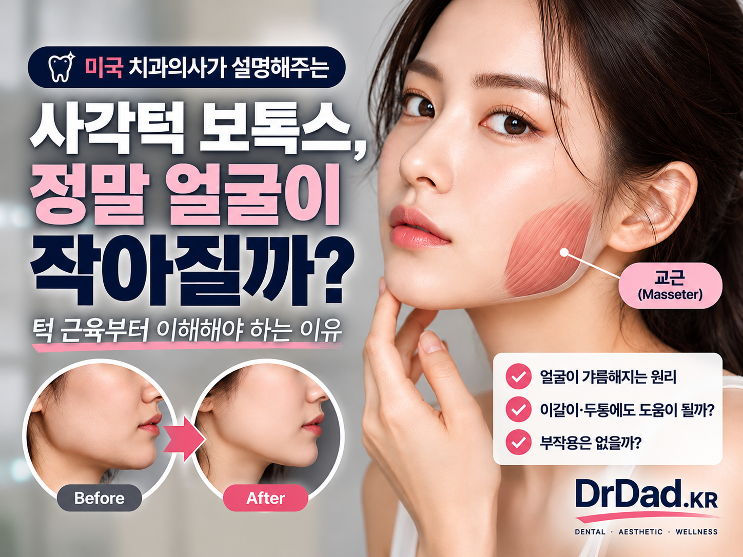 사각턱 보톡스, 정말 얼굴이 작아질까? 턱 근육부터 이해해야 하는 이유