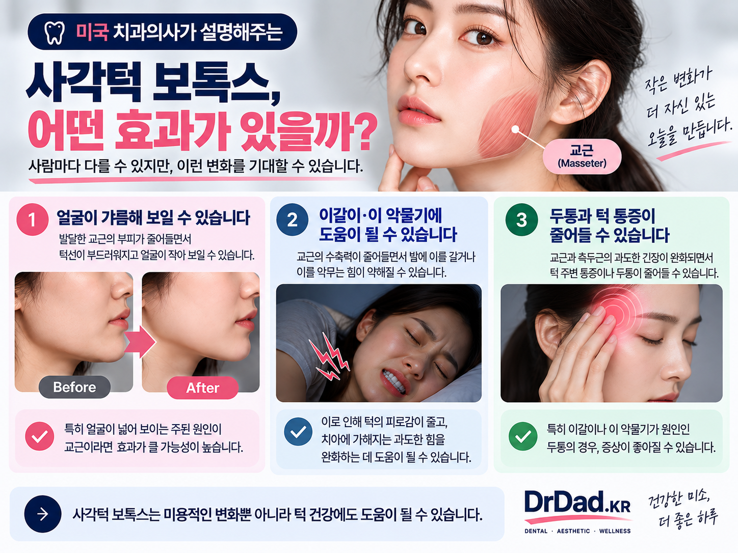 사각턱 보톡스 얼굴선 이갈이 이 악물기 턱 통증 두통 설명 인포그래픽