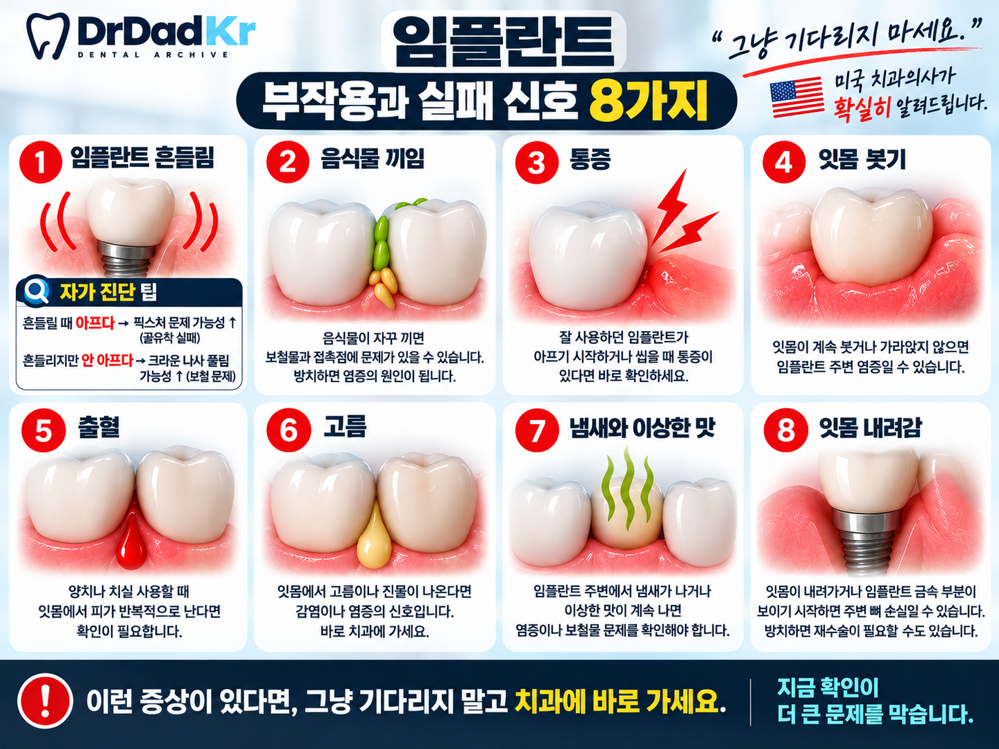임플란트 부작용 실패 신호 8가지 인포그래픽