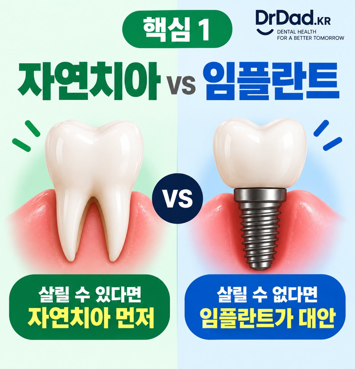 살릴 수 있는 자연치아는 최대한 살리고 살릴 수 없다면 임플란트를 고려합니다