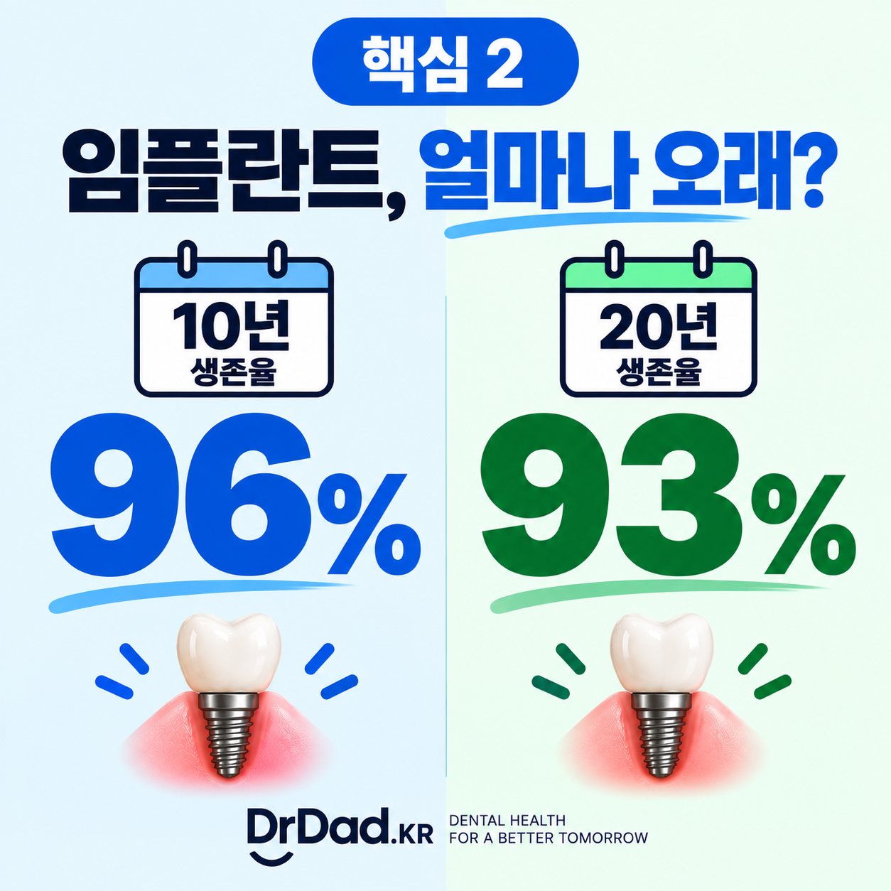 임플란트 장기 생존율 10년 약 96퍼센트 20년 약 93퍼센트